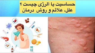 حساسیت یا آلرژى چیست؟ علل، علائم و روش درمان