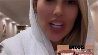 ایمپلنت یک روزه -ایمپلنت فوری