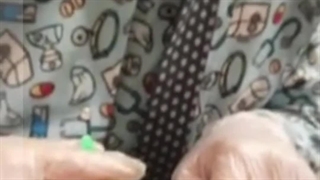 رفع گودی زیر چشم با مزو