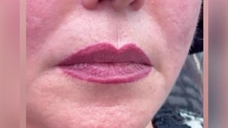 مرکز تخصصی ابرو چشم لب