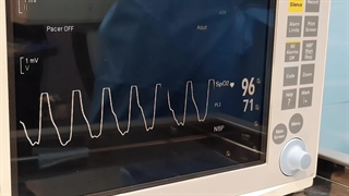 عمل لیزری دیسک در کلینیک درد مهرگان