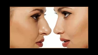 بهترین جراح بینی در تهران