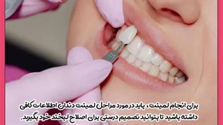 طرز گذاشتن لمینت دندان دندانپزشک زیبایی