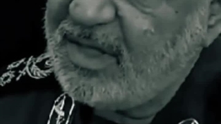 شهید سلامی جراحی لثه