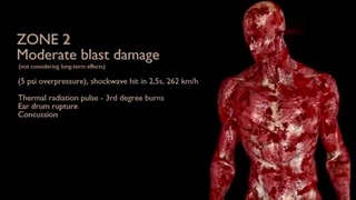 شبیه‌سازی هولناک از تاثیر انفجار بمب هسته‌ای بر بدن انسان